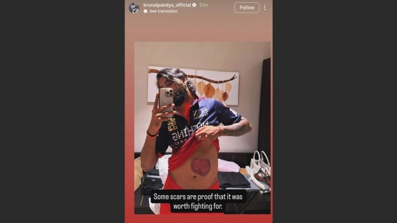 Krunal Pandya 'Battle Scars': RCB All-Rounder Reveals Physical Toll of Match-Winning Knock Against Mumbai Indians
