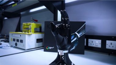 India News | Hyderabad's Bionic Hands: Restoring Lives, Rebuilding Confidence