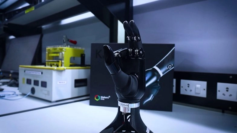 India News | Hyderabad's Bionic Hands: Restoring Lives, Rebuilding Confidence