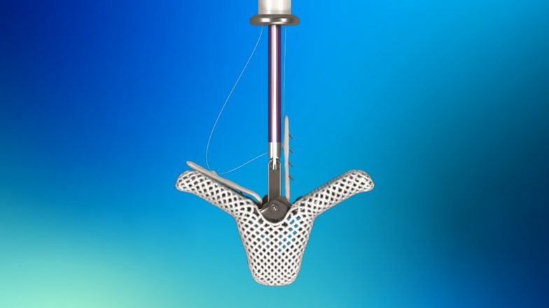 India News | TriClip™: First-of-its-kind Device to Repair Leaky Tricuspid Valve Launched in India