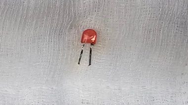 Indian Army Doctors Save Infant Who Swallowed LED Bulb With Corrosive Wires in Pune (See Pics)