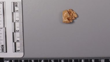 New Clues About Homo Erectus Emerge from Study of Ancient Teeth