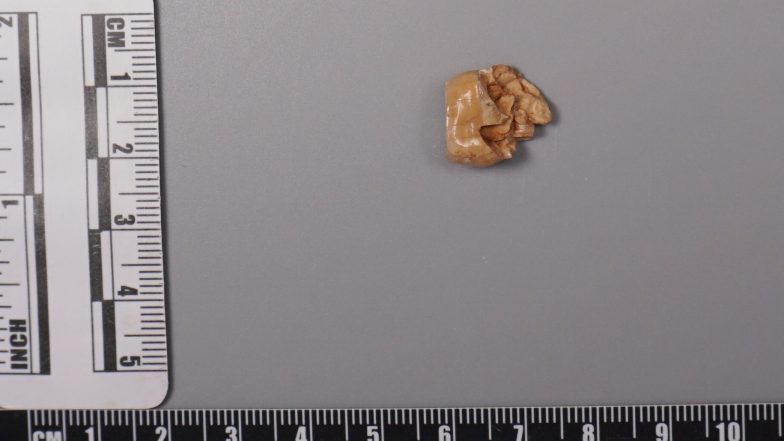 New Clues About Homo Erectus Emerge from Study of Ancient Teeth