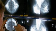 Conflicting Advice Makes It Hard to Know when to Get a Mammogram