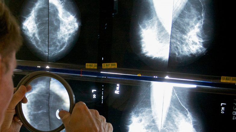 Conflicting Advice Makes It Hard to Know when to Get a Mammogram
