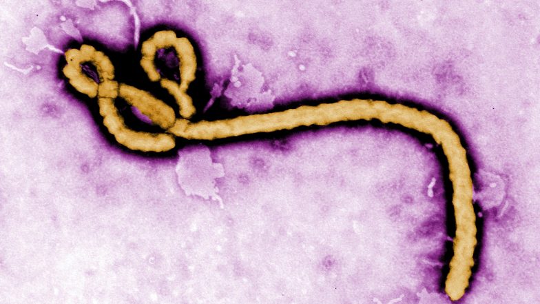 Uganda Confirms One Case of Ebola in a Congolese Man Who Died in a Ugandan Hospital