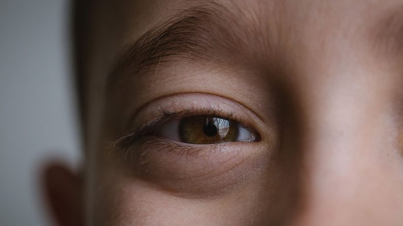China Man Loses Vision After Slapping Twitching Eyelid To &lsquo;Ward Off Bad Luck&rsquo;