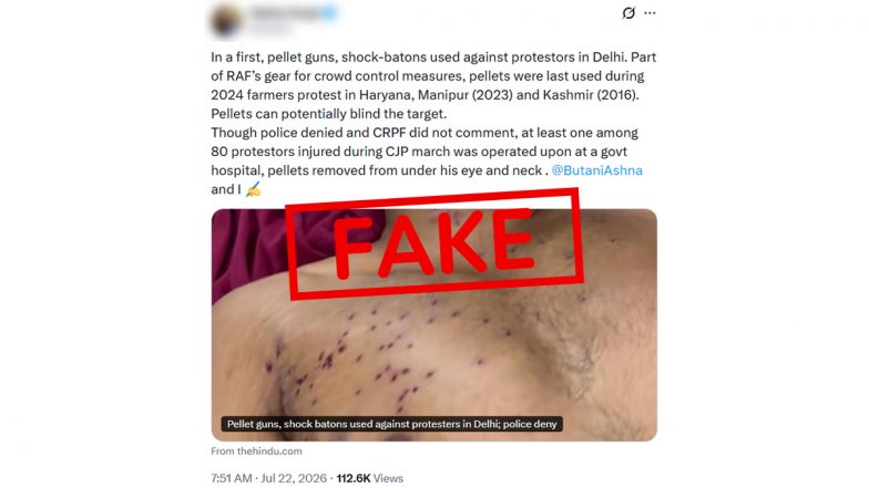 Did Security Forces Use Pellet Guns Against CJP Protesters? Delhi Police Call Claim Fake