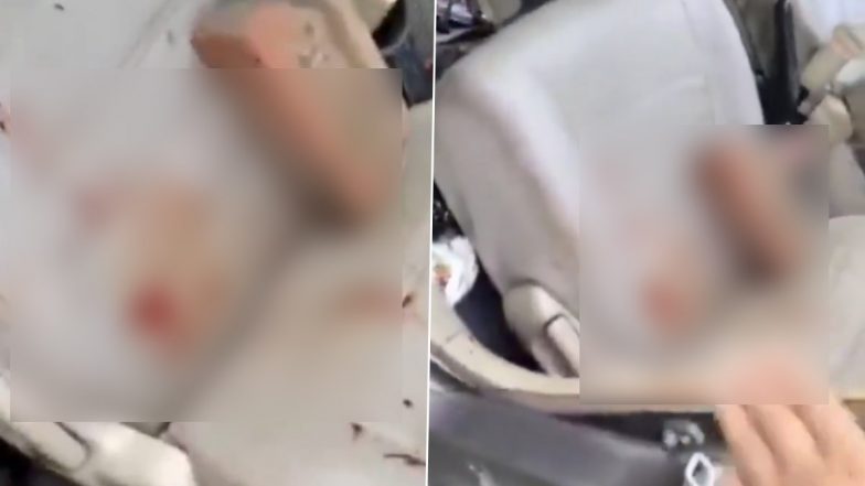 &lsquo;My Mother Is a Retired IAS Officer&rsquo;: Kanpur Man Held for Brick Attack on Girlfriend (Video)