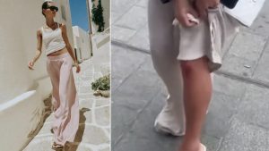 social-viral-Viral Zara Trousers Fit Issues Explained: Why Shoppers Call Them ‘Death Pants’