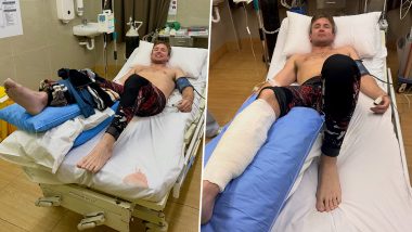 Fiji Shark Attack: New Zealand Influencer Henry Gibbs Shares Recovery Update After Surviving Dive Horror