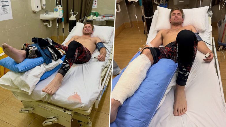Fiji Shark Attack: New Zealand Influencer Henry Gibbs Shares Recovery Update After Surviving Dive Horror