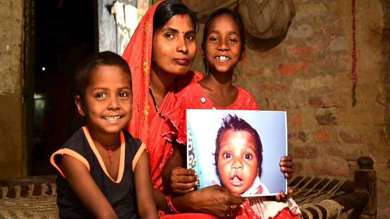 Business News | On World Cleft Awareness Day, Smile Train India Marks 800,000+ Free Surgeries and a Renewed Push for Early Diagnosis of Clefts