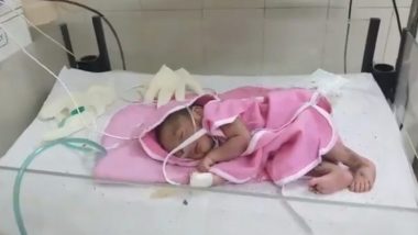 Bengaluru: Baby Girl Suffers Skull Fracture After Father Throws Her Over Naming Ceremony Delay