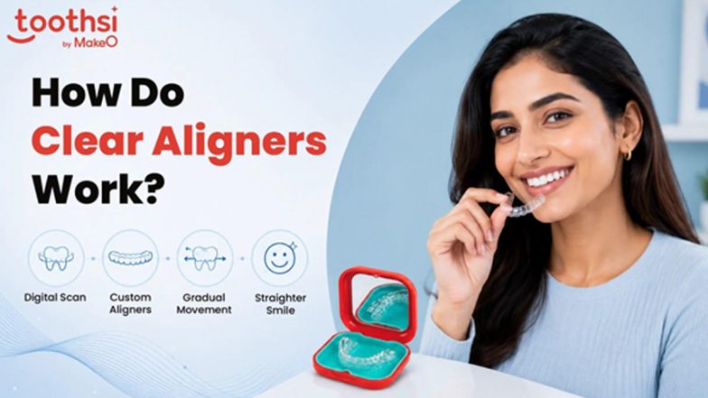 How Do Clear Aligners Work?