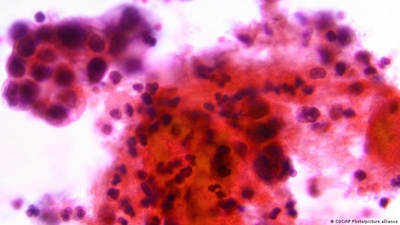 Study Shows Why Younger Generations May Be More Cancer-prone