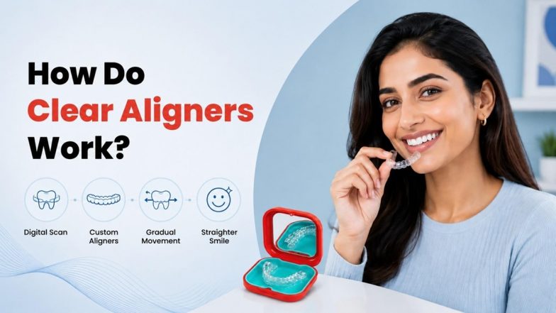 How Do Clear Aligners Work?