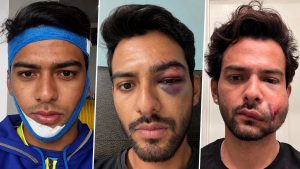 Unmukt Chand Shares Graphic Photo of Facial Injury After On-Field Collision