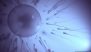 Male Infertility: 'Grossly Underreported' and Misunderstood