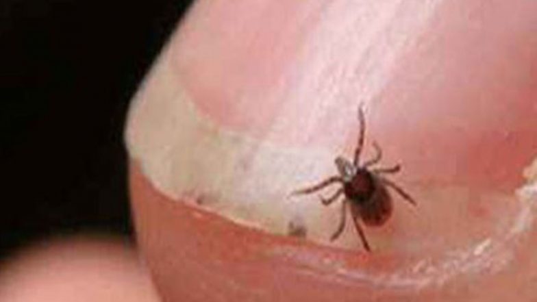 India News | 24 Scrub Typhus Cases Reported in Shimla in Ongoing Monsoon Season; Health Department Issues Advisory