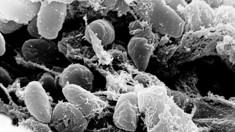 Pneumonic Plague: Symptoms, Fatality Rate and Treatment After Darya Shipilova&rsquo;s Death in Russia