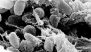 Pneumonic Plague: Symptoms, Fatality Rate and Treatment After Darya Shipilova’s Death in Russia