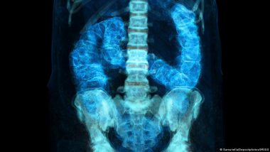 Early-onset Cancer: Why Cases Are Rising in Under-50s