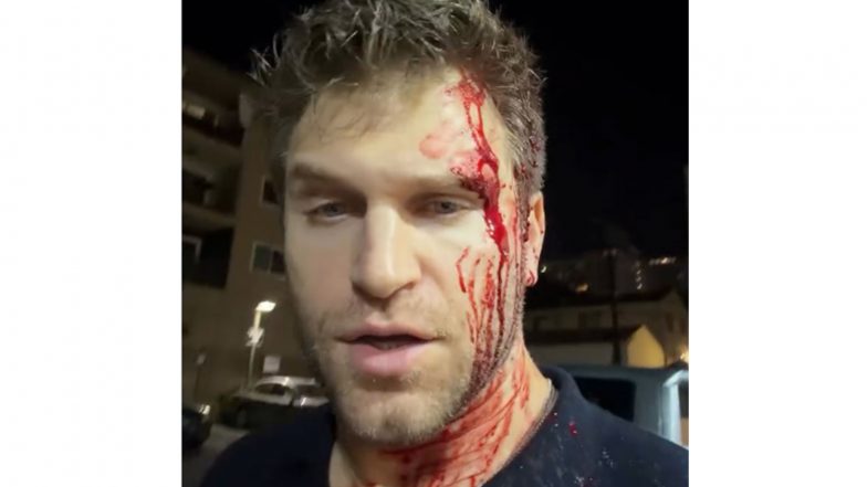 Entertainment News |  ‘Pretty Little Liars’ Star Keegan Allen Says He Was Beaten, Robbed at Gunpoint